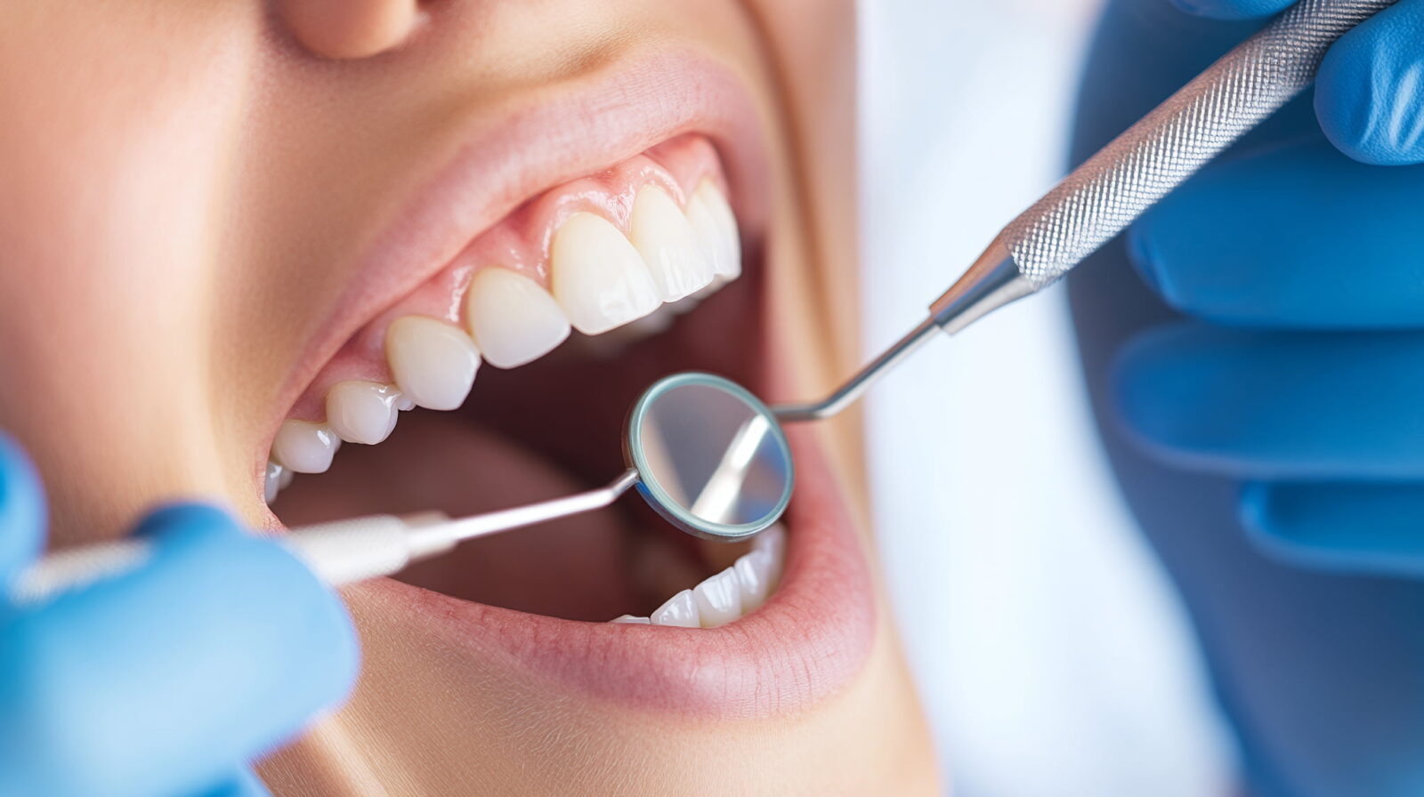 歯科医院でインプラント周囲炎のチェックを受ける女性