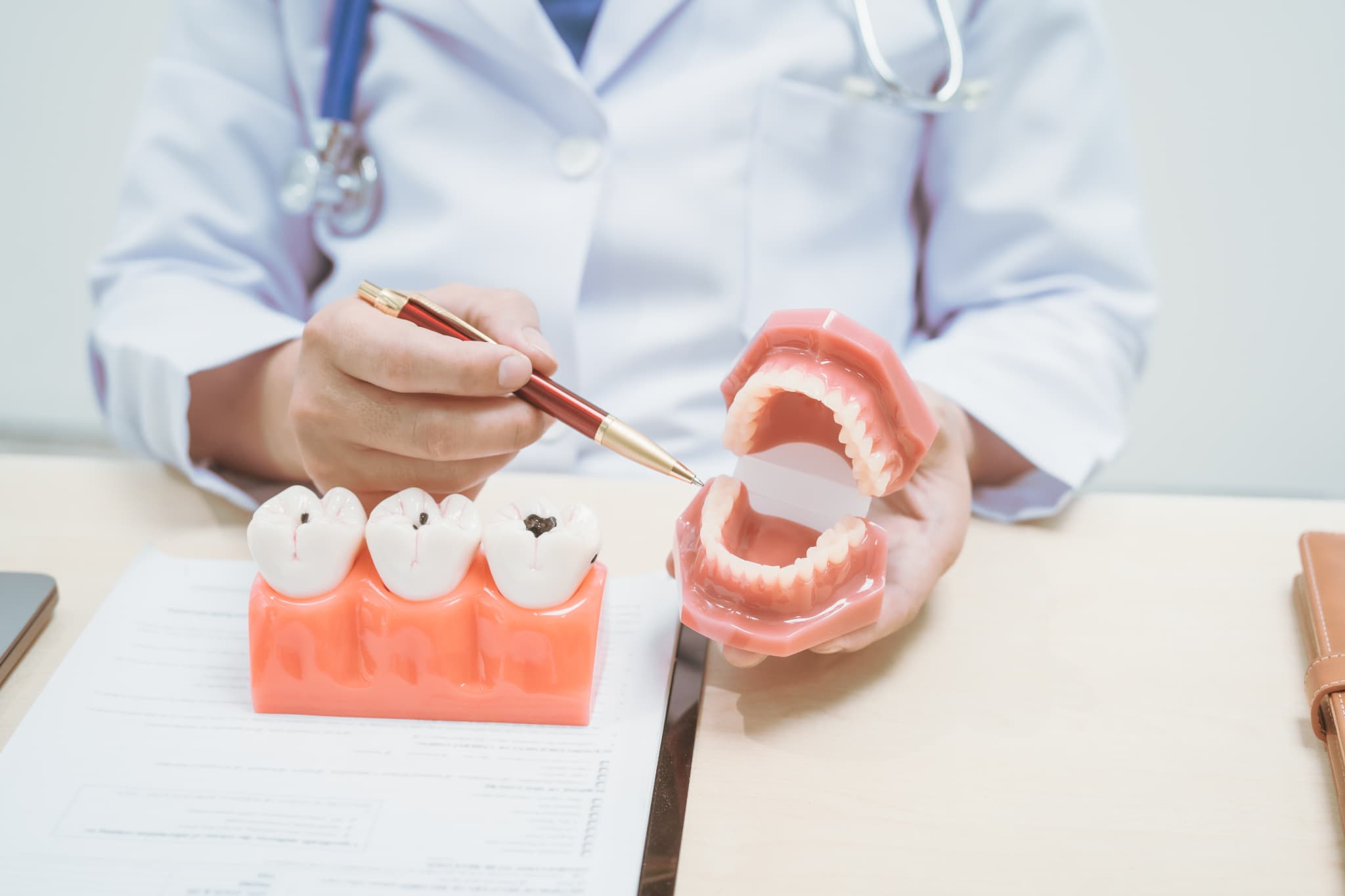 親知らずの虫歯について説明をする様子