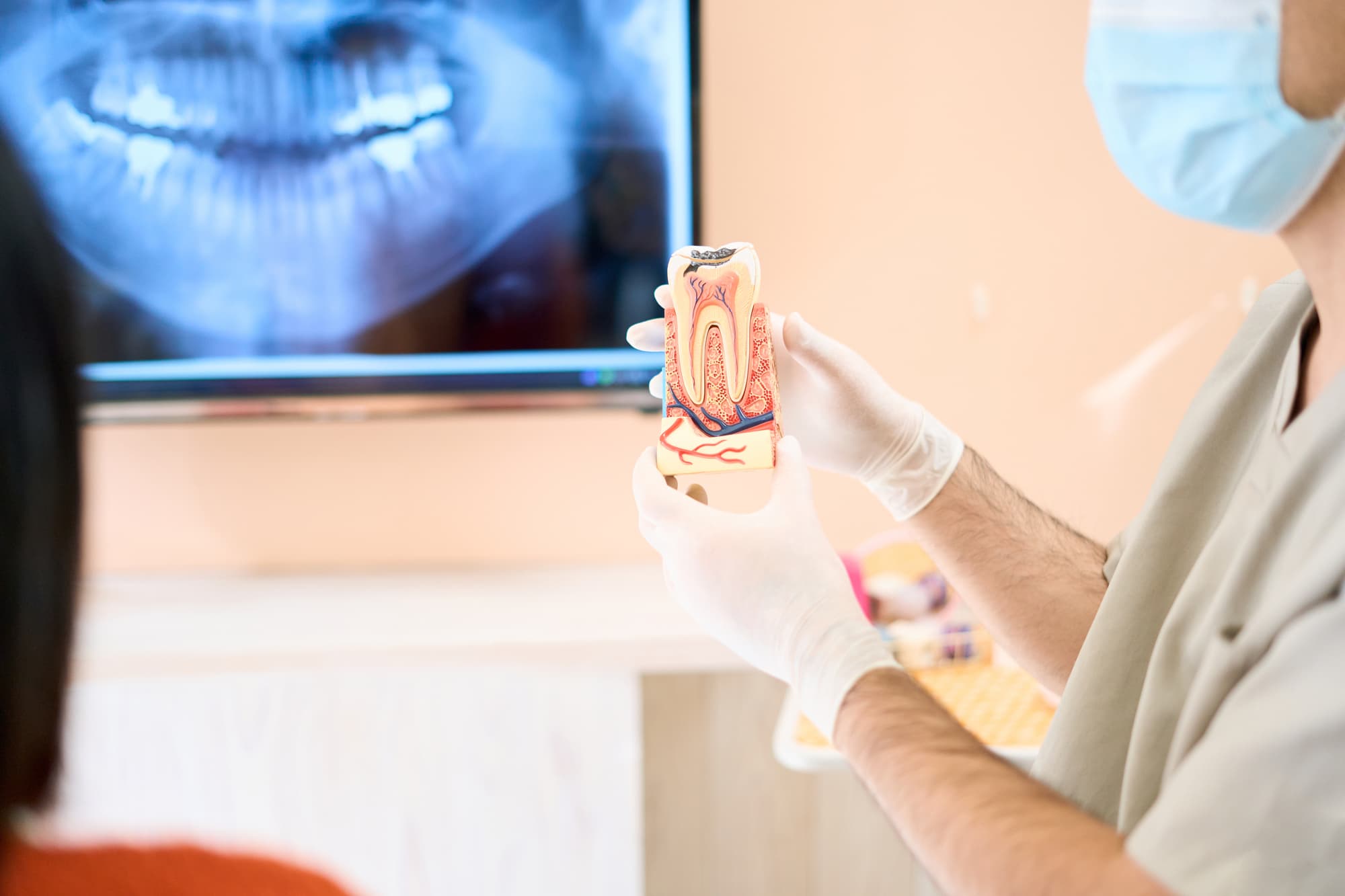 歯の模型を使って根管治療の説明をする歯科医師