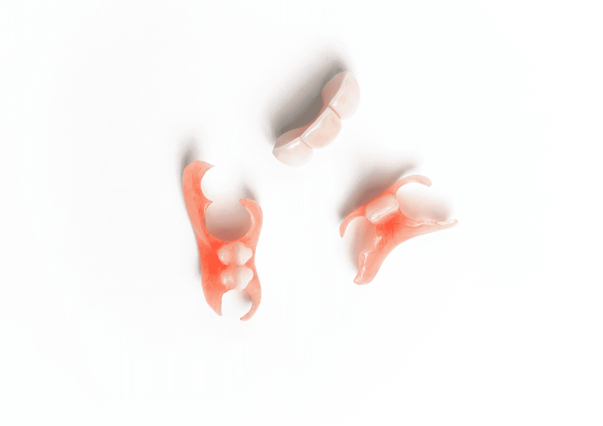 インプラント治療ができない場合の部分入れ歯やブリッジ