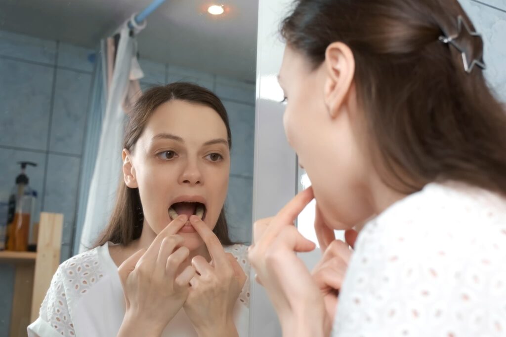 マウスピースがフィットせず違和感を感じる女性